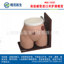 厂家直销特价出售 造瘘管造口术护理模型高级瘘管造口术护理模型