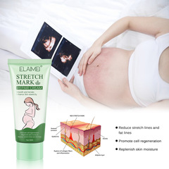 ELAIMEI Postpartum Stretch Mark Removal Cream Lifts, Firms, and Fades Postpartum Pregnancy Marks Stretch Marks Obesity Stretch Marks