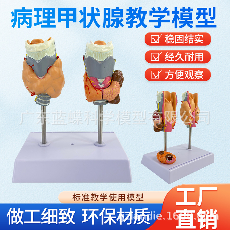 ���岡����״��ģ�ͼ׿��׵��ڷ���ϵͳҽѧ���ʼ�״�ٺ�ͷ�̾�