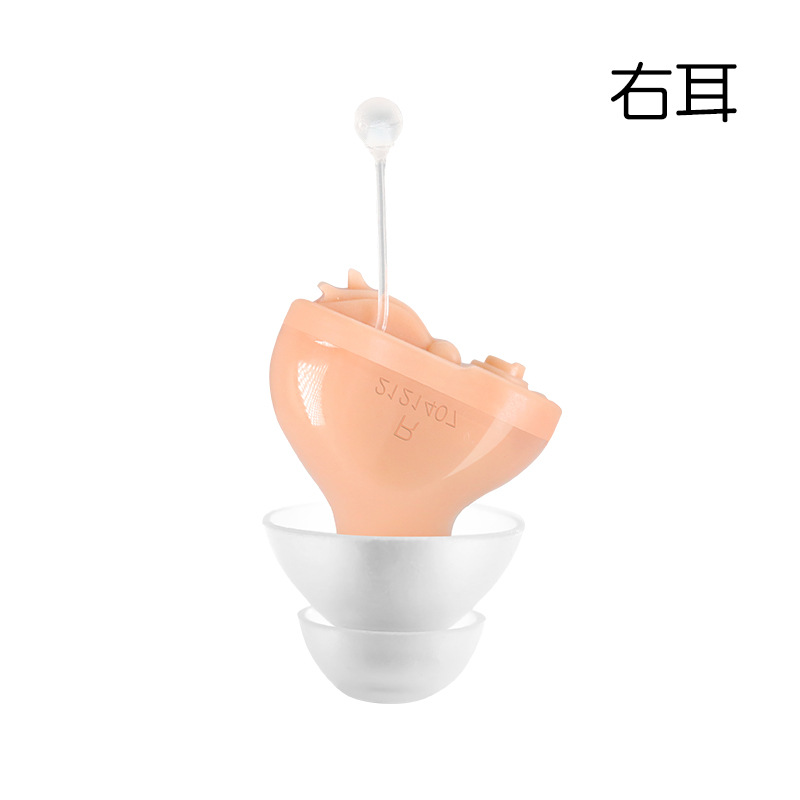 Skin color right ear 