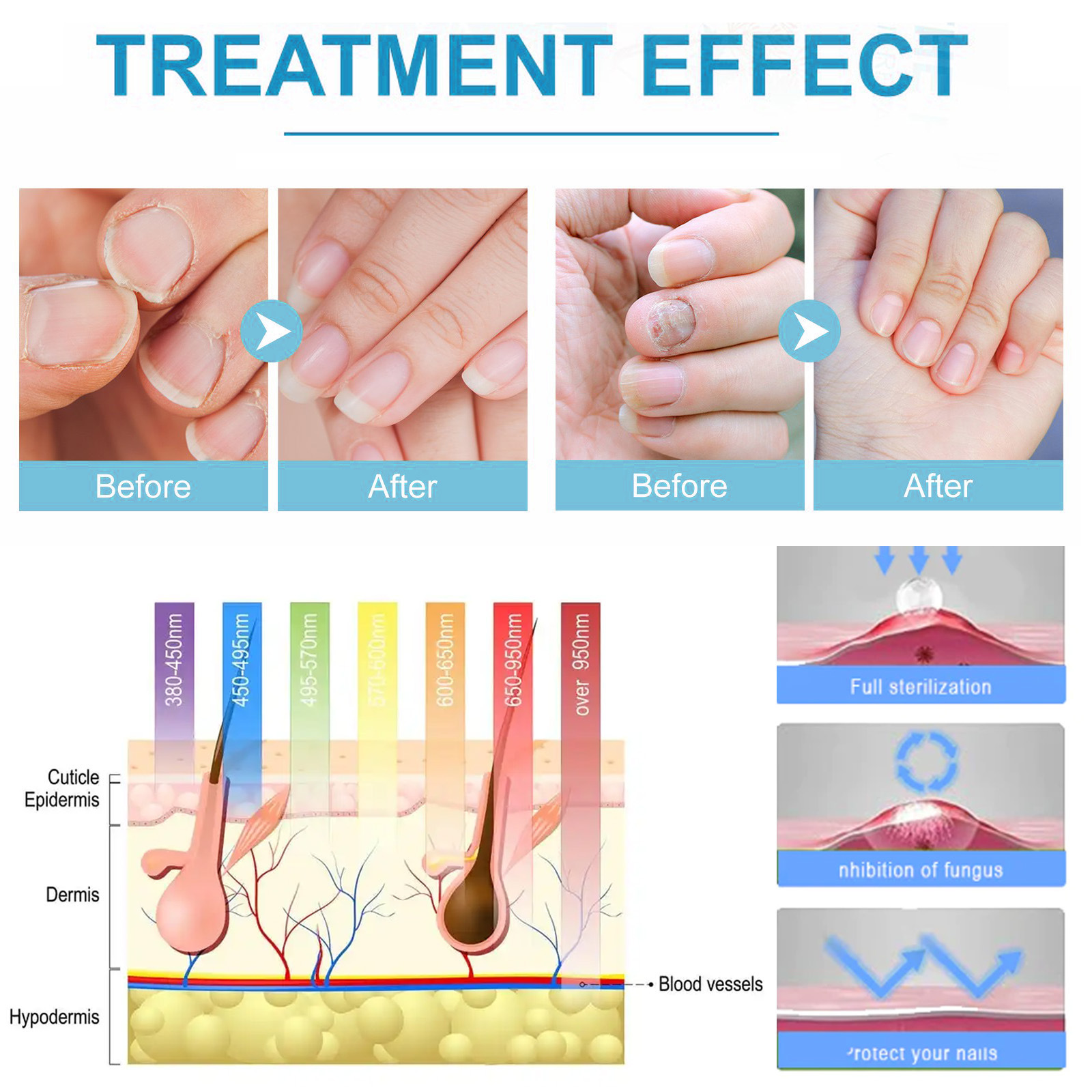 Effective Nail Treatment Results