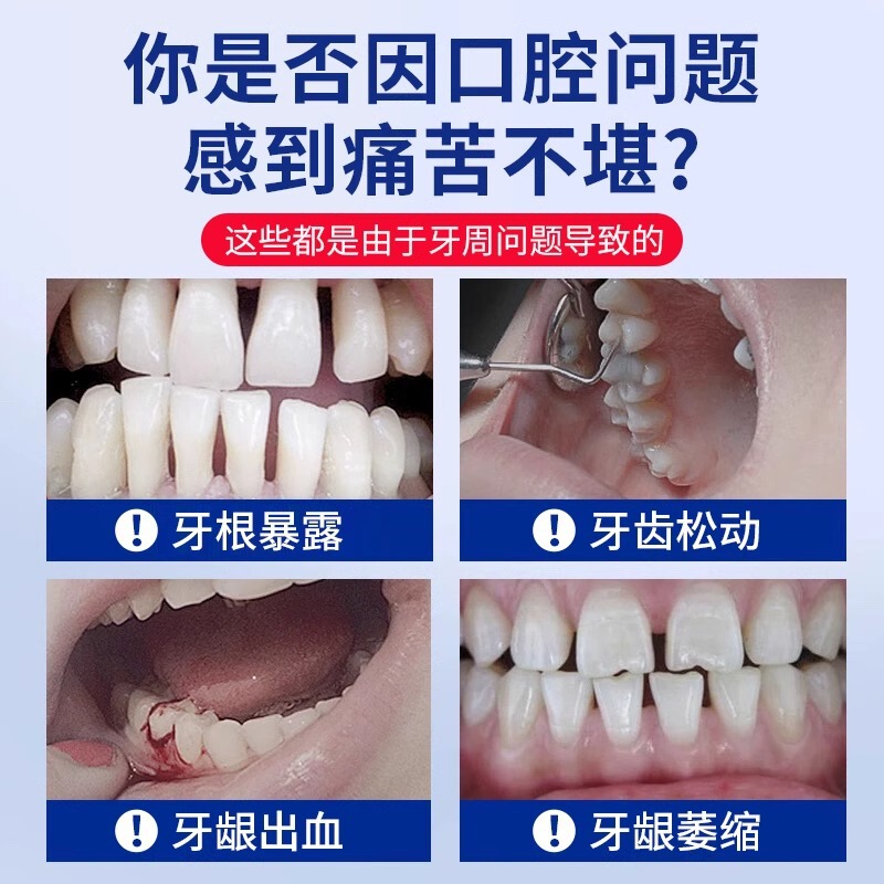 修正医療用口腔脱感作歯磨き粉、抗アレルギー、歯ぐきの出血、知覚過敏、息を爽やかにする、虫歯予防、歯のケア歯磨き粉|undefined