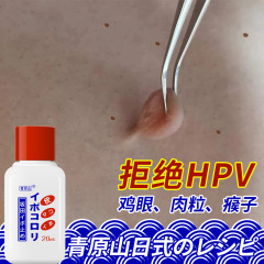 青原山鶏眼膏日本式処方しんしん骨膏肉粒子鶏眼外用抗菌液の代理