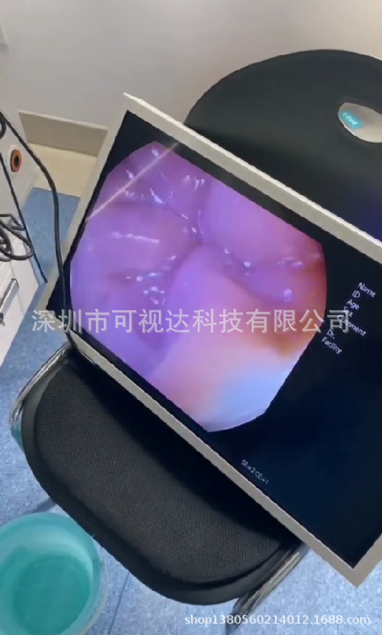 SDI监视器 BNC工业监视器 医院肠镜胃镜SDI显示器 AV HDMI显示器