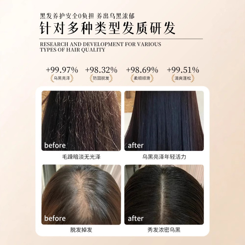 Daqingsi 抗脱毛シャンプー、髪を固め、オイルをコントロールし、ふわふわ、ふけ防止、滑らか、男性と女性のための正規品卸売ヘアドロップ|undefined