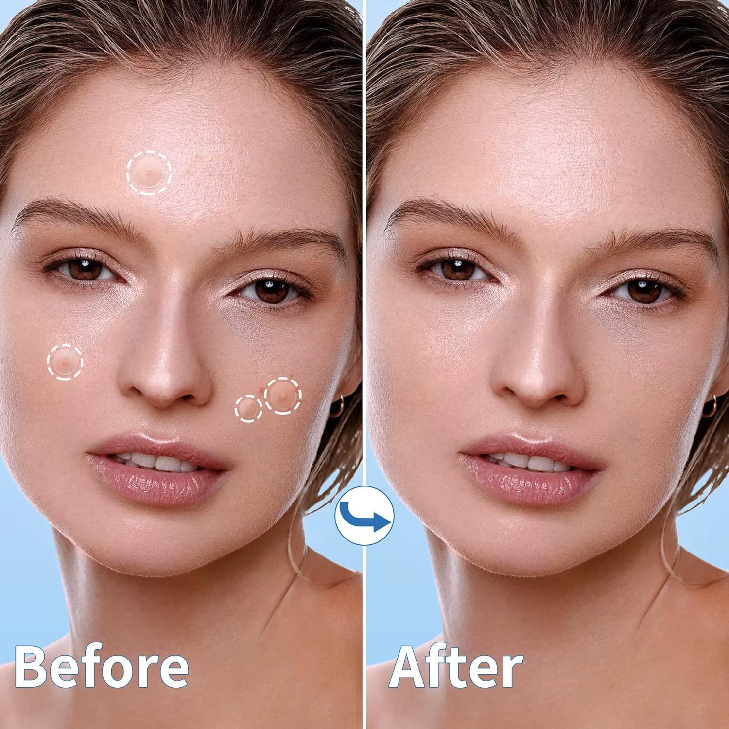 (Кросс-продажи), прозрачная ультратонкая пластырь от черных точек acne 360 штук, против акне