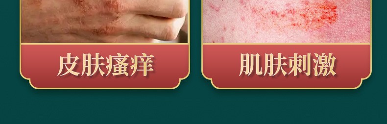 Five-Toxin Anti-Itch Cream, Plant-Based Mosquito Bite Cream, Dry Cracked Skin Itching Cream, Peeling Soothing Cream, Anti-Itch Herbal Antibacterial Cream detail image