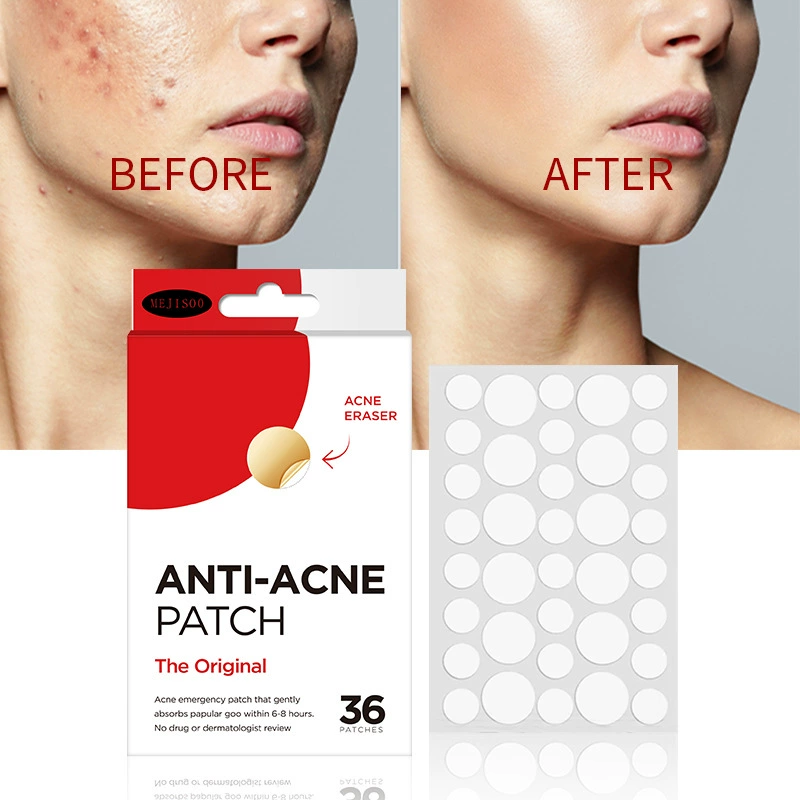 Внешняя торговля Английский ANTI-ACNE PATCH прыщи прыщи 36 прыщей коллоидные прозрачные невидимые прыщи