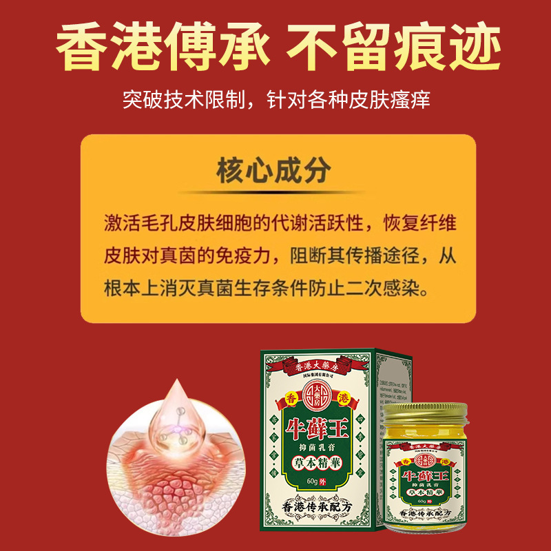香港牛苔王軟膏 頭皮・太もも・銀皮症専用正規品を工場直販|undefined