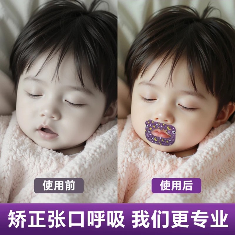 闭口贴打呼噜止鼾器口呼吸成人矫正贴封嘴儿童嘴巴睡觉防张嘴神器|undefined