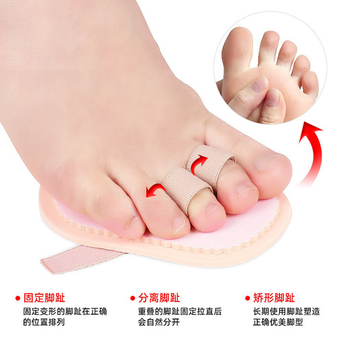 Toe separator, metatarsal pad with thumb overlap hammer toe share, breathable sweat-absorbent anti-wear anti-pain front foot pad