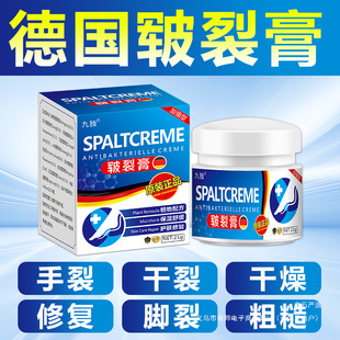 German Chapped Cream for Rough, Dry and Cracked Heels, Peeling Hands, Peeling and Cracked Cream