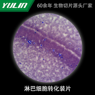 Lymphatic Cell Conversion Flake Biological Slice Laboratory Research Microscope Slide College Teaching Microbial Science