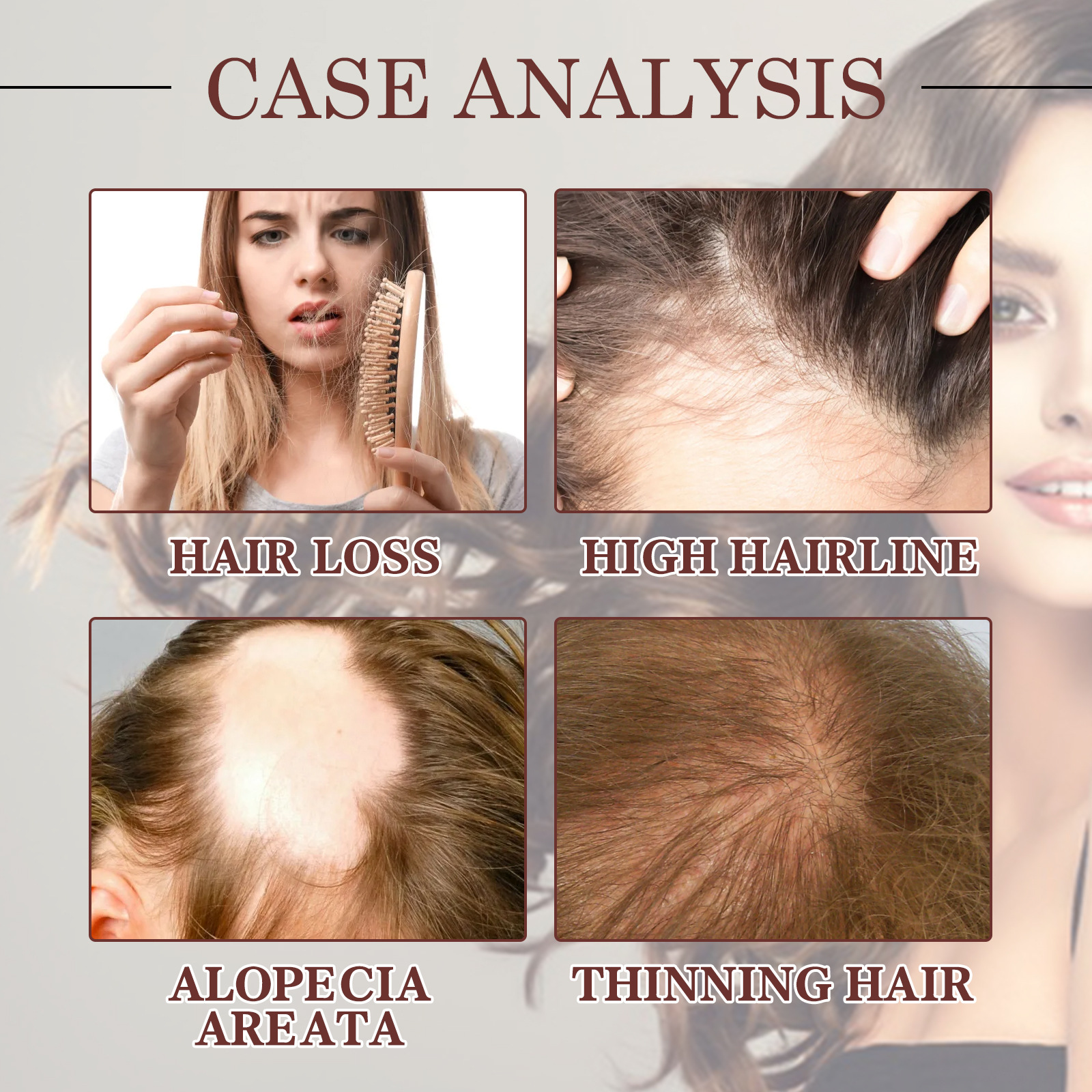 Jaysuing pour cheveux de noix de coco hydrate, nourrit les cheveux denses et forts et masse l'huile d'essence du cuir chevelu,_voghion.com