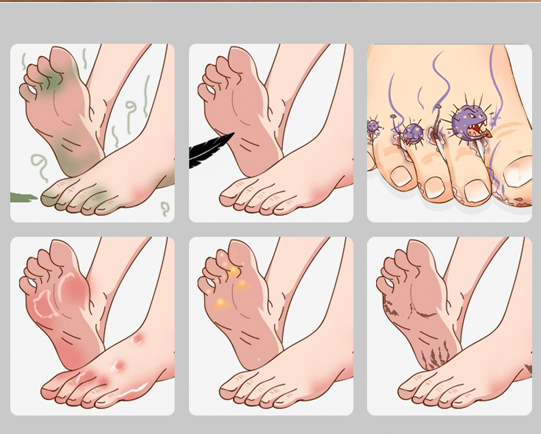 Yao Benren Foot Care Ointment 20g Herbal Cream for Foot Discomfort External Use quality and texture
