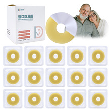 �羳������ڷ�©Ȧ��ڷ�©�����N�h Ostomy Barrier Ring�����
