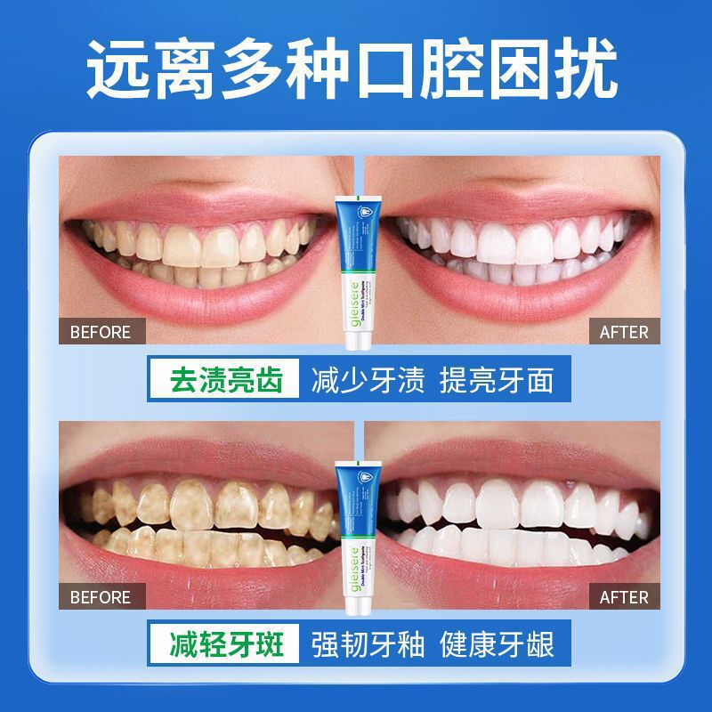 正規品の国境を越えた歯磨き粉、歯を保護し、歯ぐきを強化し、マルチ効果のある爽やかな白茶歯磨き粉、氷のように冷たくて明るく、歯を強化し、口臭を防ぎます。|undefined