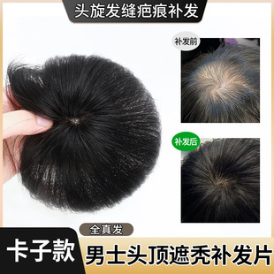 Wig Men's Full Real Hair Top Head Rotation Slit Scar Reissue Pieces Hand-in-hand Rotation Cover Alopecia Areata Men's Wig