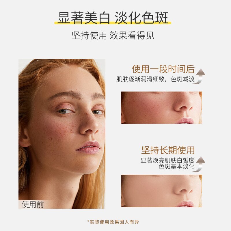 Dinkiss高雅美白はぶちの精華液を取り除きます。|undefined