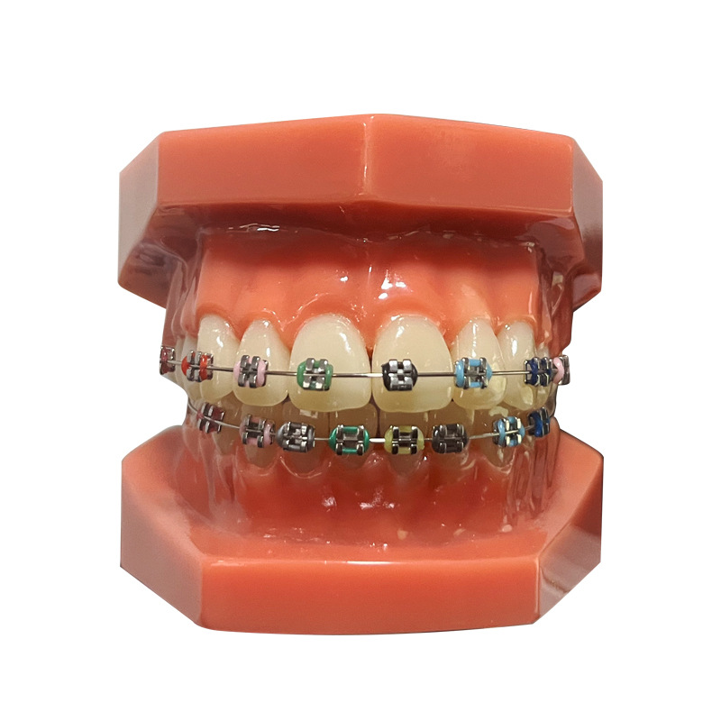 Modelo dental, modelo de corrección de demostración de mandíbula incorrecta, práctica de dentista, modelo de brackets pegajosos, molde de enseñanza de corrección