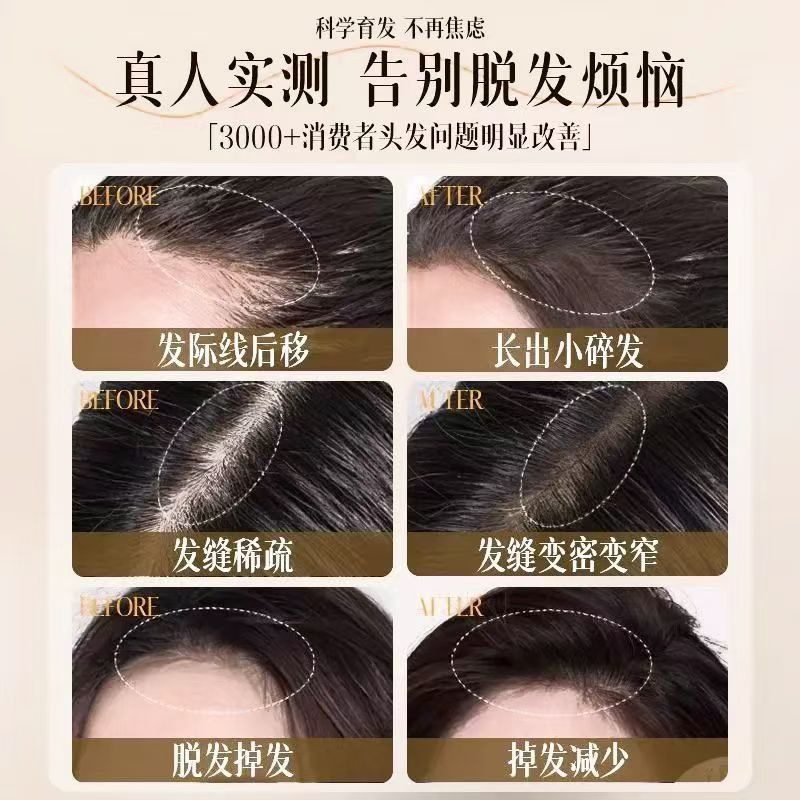Qiweitang anti-desprendimiento champú 8 plantas pesadas para el cuidado del cabello limpio de gran capacidad jengibre champú para el cabello fijo fabricante image 5