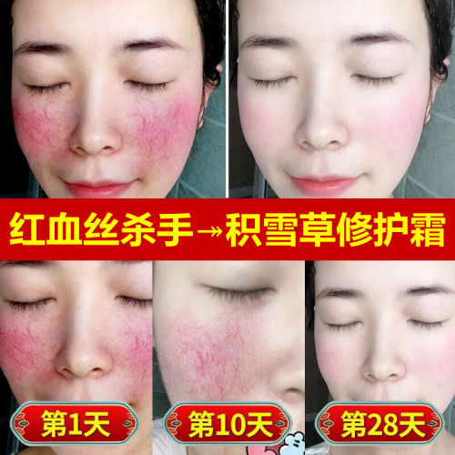 Sensitive Skin Repair Cream Centella Asiatica Essence Soothing Redness Thickening Stratum Corneum Beauty Salon Redness Reduction Face Cream