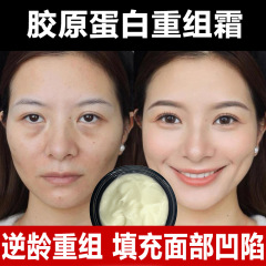 コラーゲン充填再構築クリームしわを除去し、小じわを軽減し、しわ防止ポリペプチドアンチエイジング再構築引き締めエッセンスクリーム