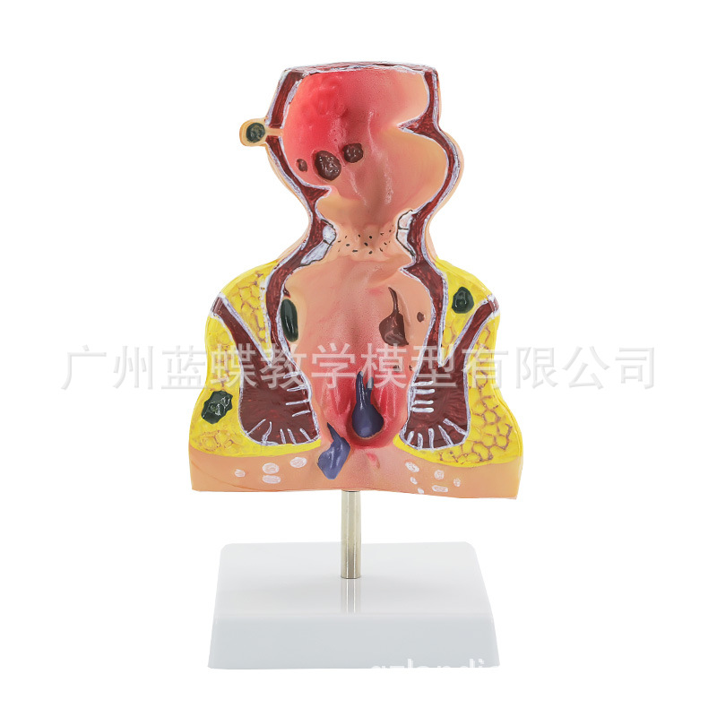 רҵ�ع�ֱ������ģ�� ����ֱ������ģ�� ��¥̽�� �̴�ģ�� ����