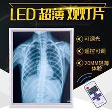 �Ƭ���t��С�ͳ���xƬ����led���{�����Ƭ͸���Ƭ��Ƭ���^Ƭ��