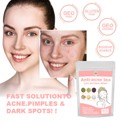 国境を越えた対外貿易戦痘茶青春痘anti- acne Detox teacne-Fighting Tea