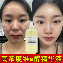 レチノール抗シワエッセンス引き締めしわ除去美白小じわアンチエイジング保湿エッセンス美容室本物の卸売