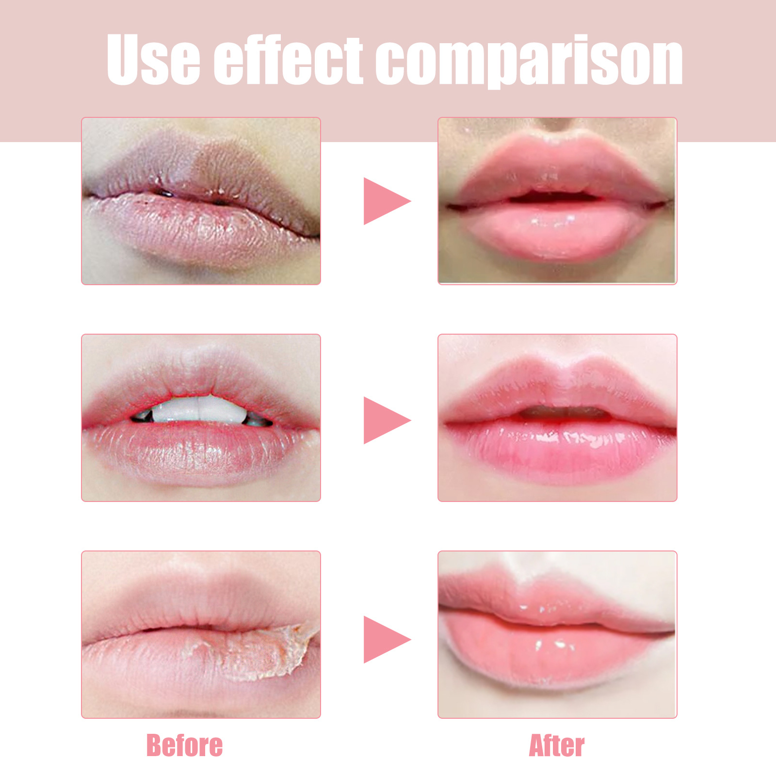 OUHOE Lubricating Moisturizes Lines, for Lip Peeling, Anti Dry Cracking, and Rich Care Oil_voghion.com