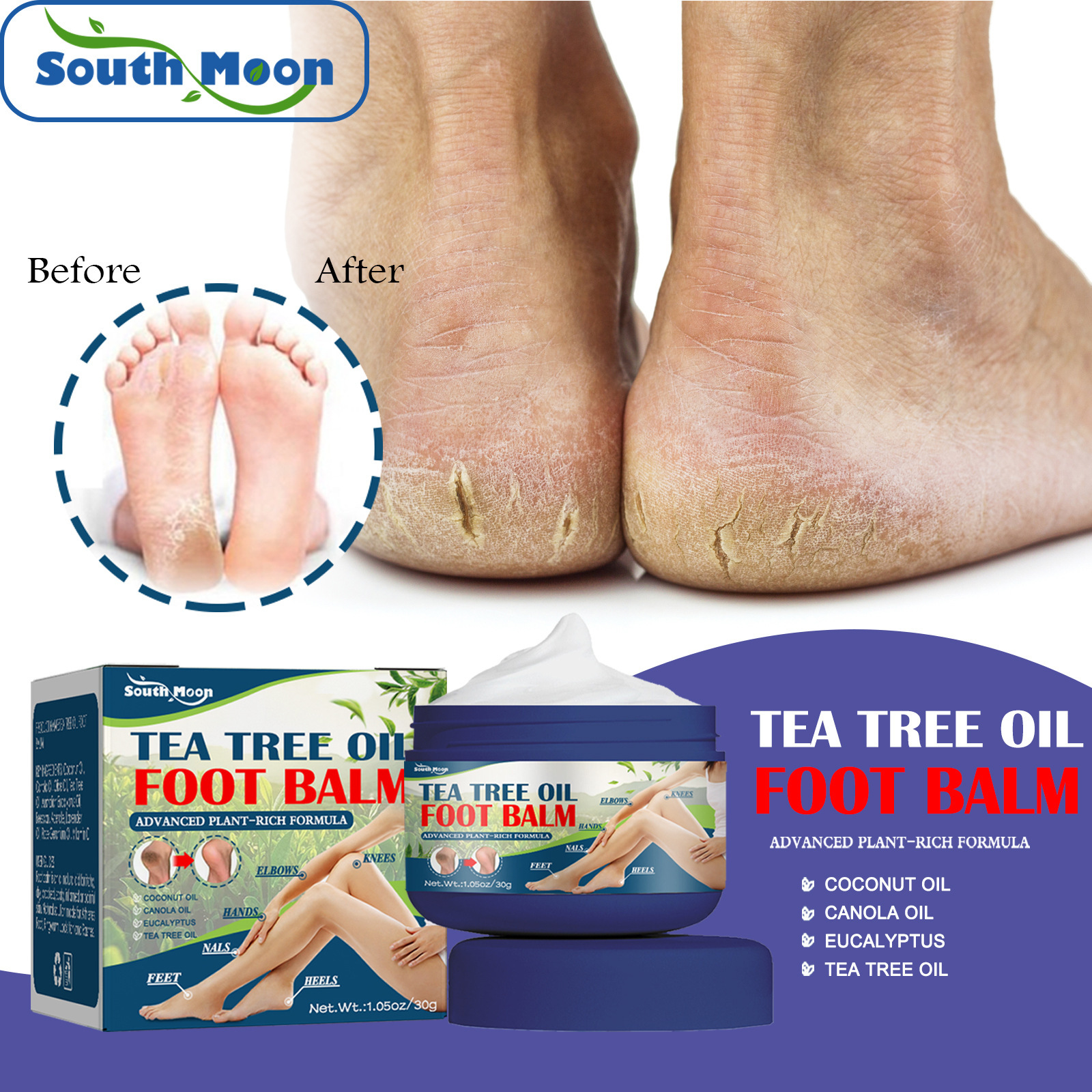 south moon urea hand and foot cream moisturizes skin, improves chapped, dry and itchy moisturizing anti-drying hand cream and foot cream