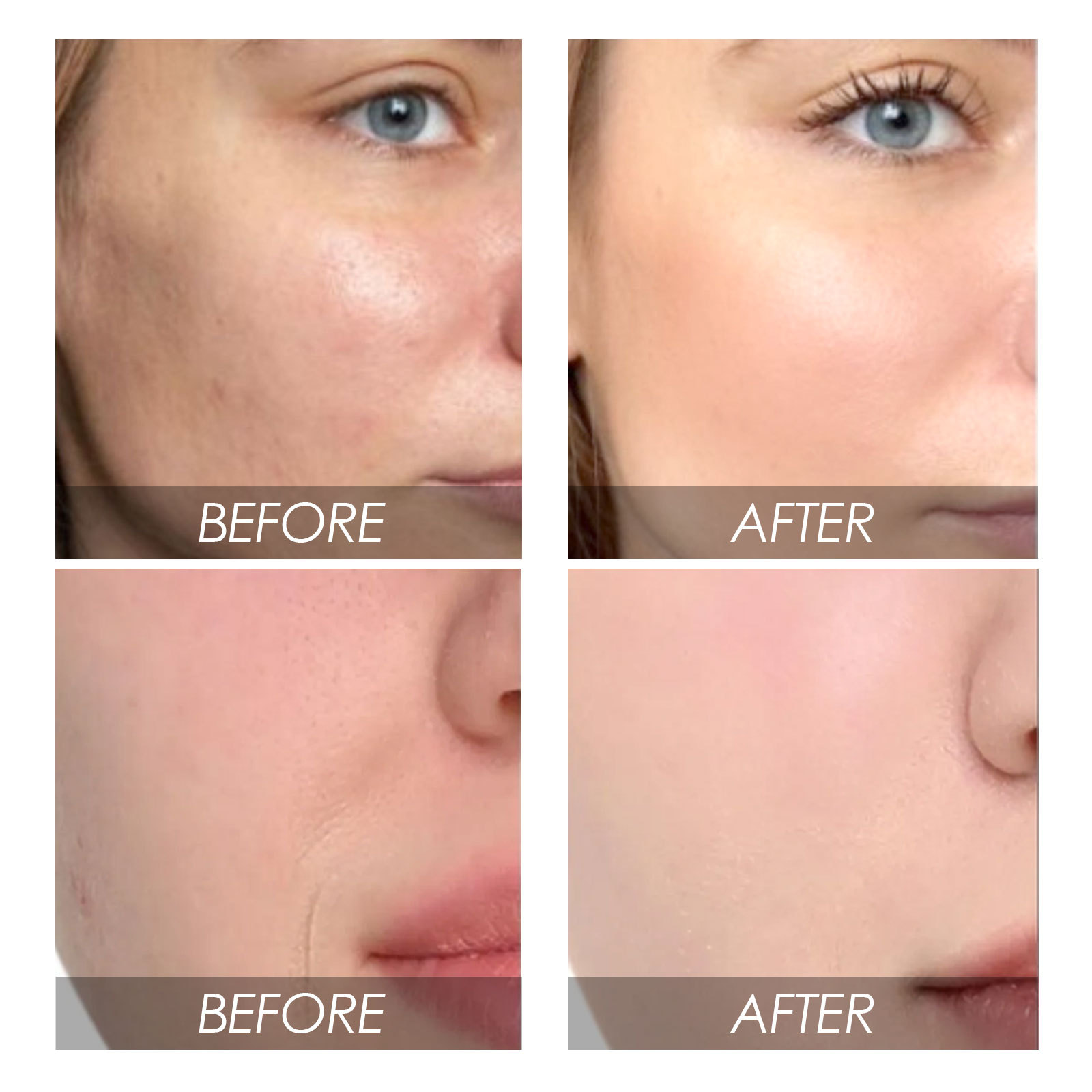 EELHOE 牛油果西瓜面部精華液 淡化細紋緊緻毛孔補水潤膚煥白精華