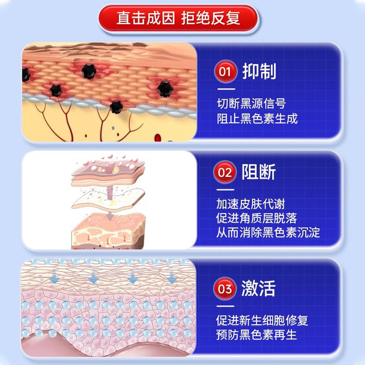 首のメラニン沈着を除去し、首のメラニンを除去し、太りすぎや黒ずみを除去する黒い棘皮症軟膏を長期間開発|undefined