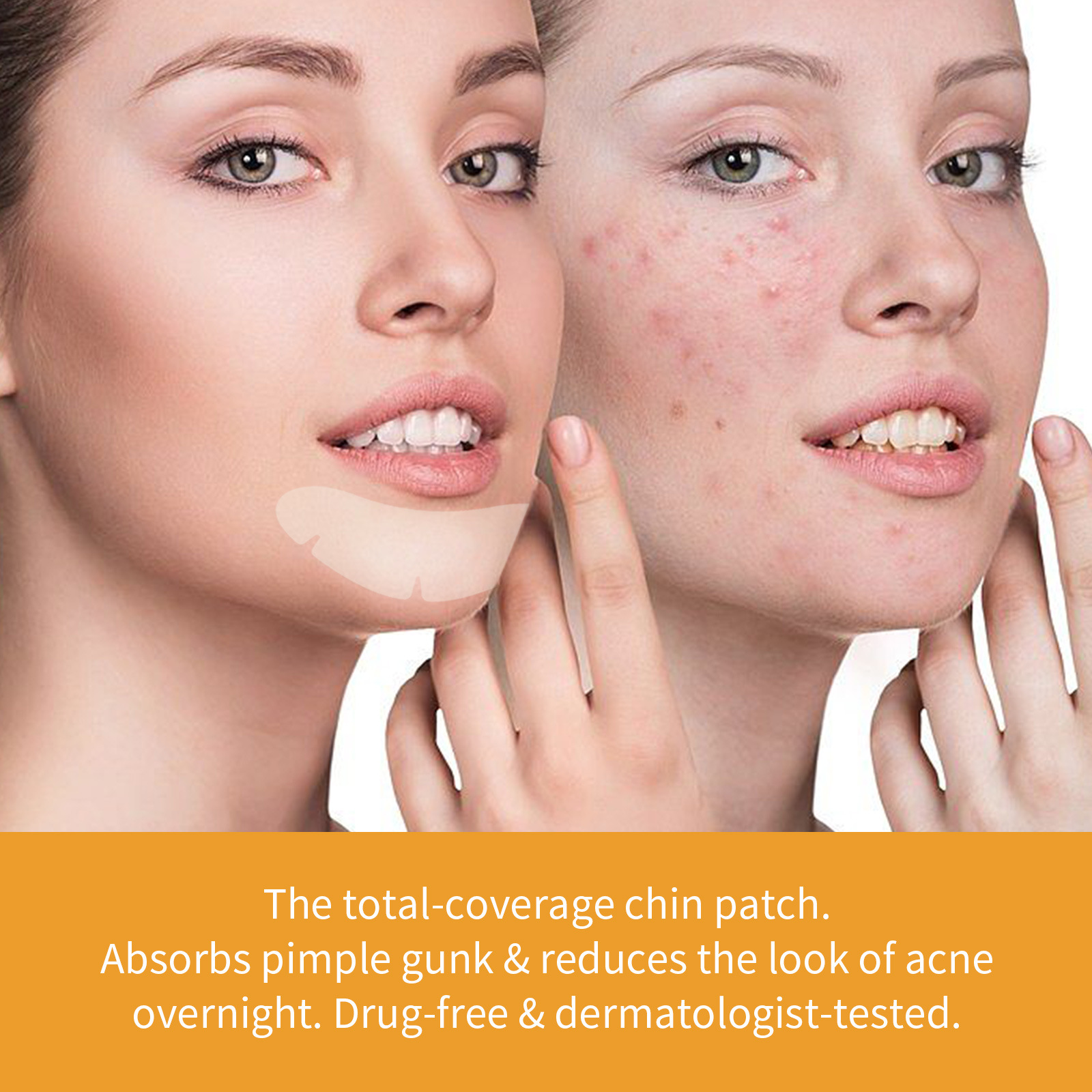 Jaysuing Chin Gel Patch de nettoyage portable pour enlever et imprimer l'acné_voghion.com