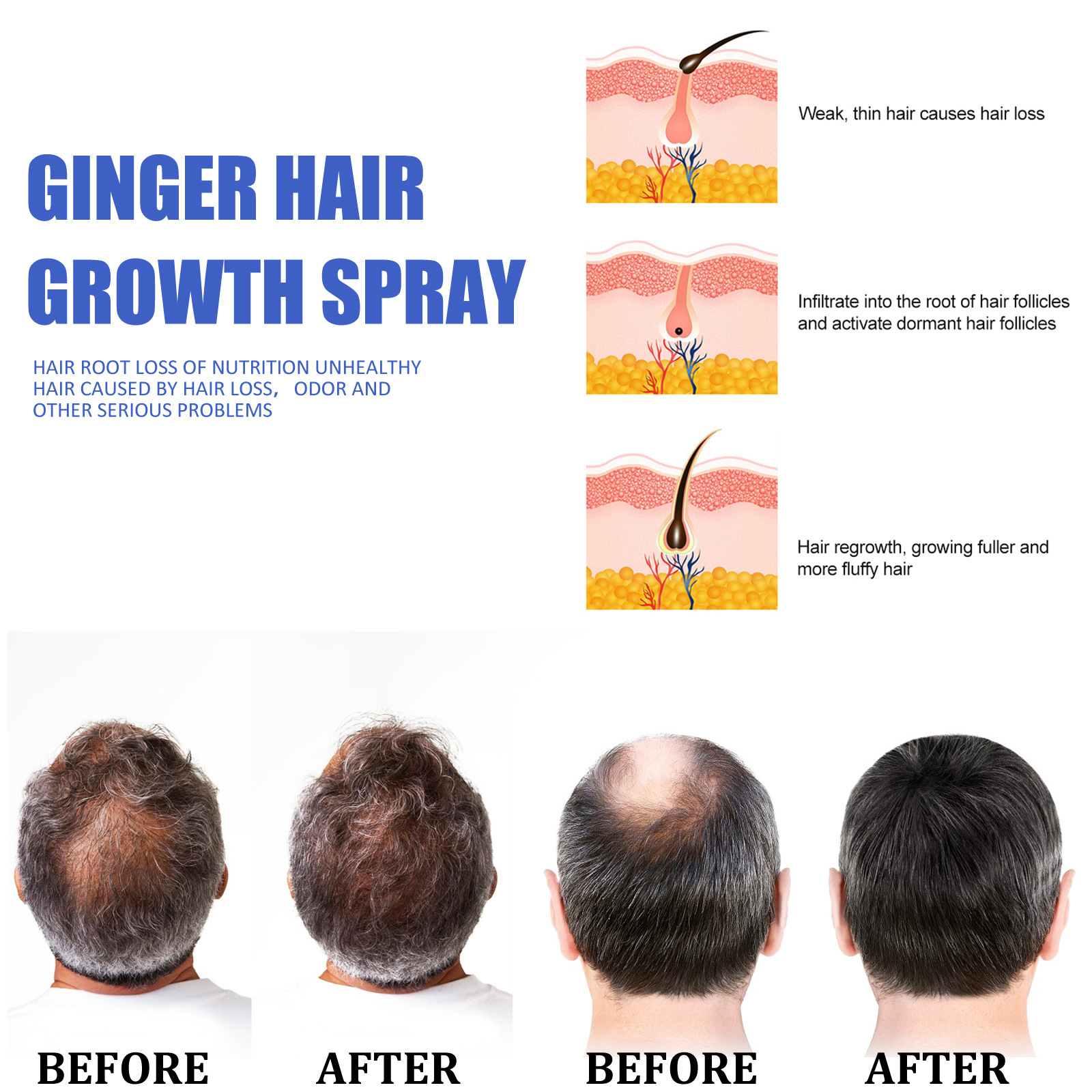 EELHOE Ginger Growth Scalp Massage Moisturizing Thick Hair Care Nutrition spray_voghion.com