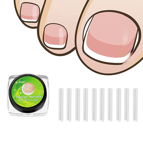 Inset nail C- shaped filling pad nail pad nail correction pad sleeve card slot Amazon explosion model nail correction device