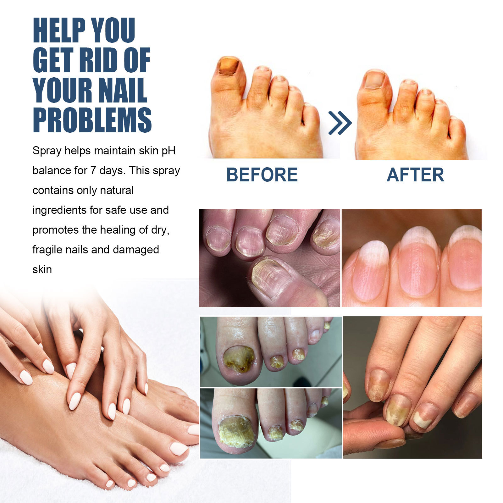 South Moon Nail Spray 10