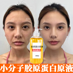 コラーゲン原液 リフトアップ、引き締め、埋め込み、くぼみ、しわ取り、ほうれい線、カテゴリー3組換え、保湿、シワ改善エッセンス