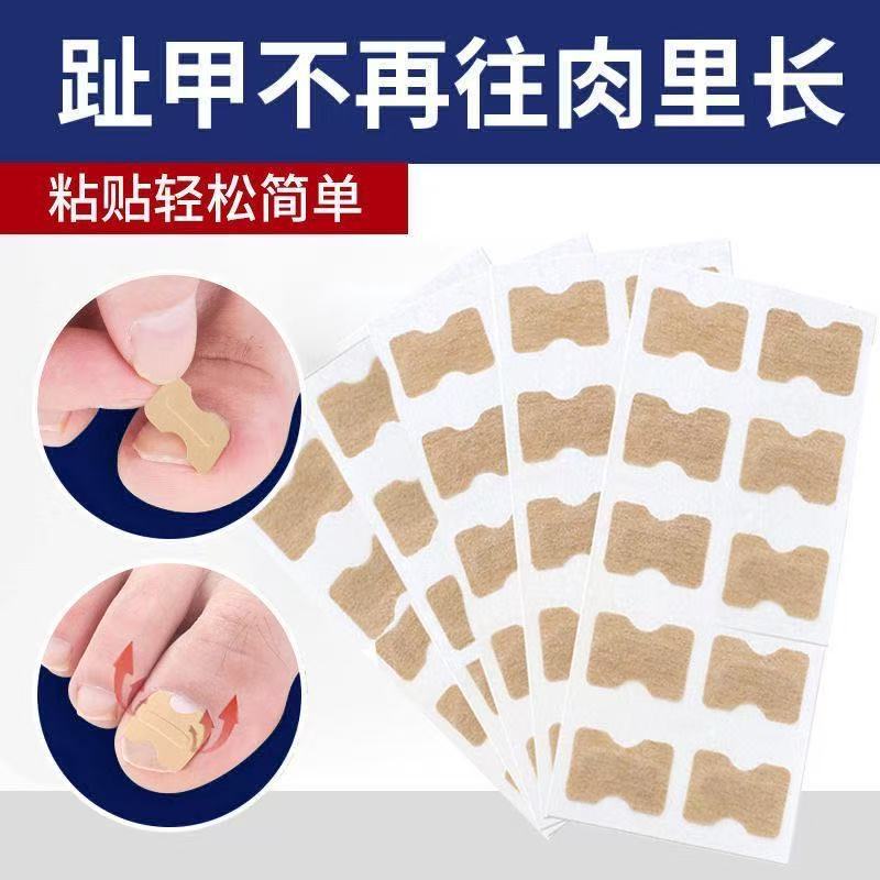Toe Ingrown Nail Correction Patch, Nail Groove Pad, Home Nail Correction Patch, Nail Ingrown Correction Device, Nail Groove Repair Corrector