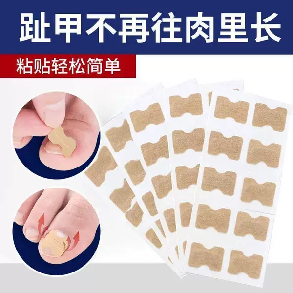 Toe Ingrown Nail Correction Patch, Nail Groove Pad, Home Nail Correction Patch, Nail Ingrown Correction Device, Nail Groove Repair Corrector