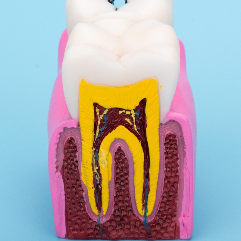 Oral Hospital Doctor-Patient Communication Teaching Model, Dental Bilateral Comparison Display, Denture Teaching Mold Ornaments