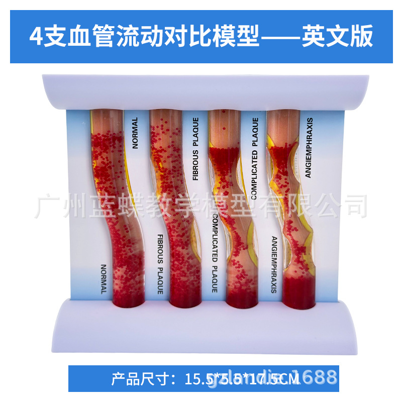 ���������״��������Ѫ�ܶ���ģ��Ӳ��ģ����������ģ��Ѫ˨ģ��