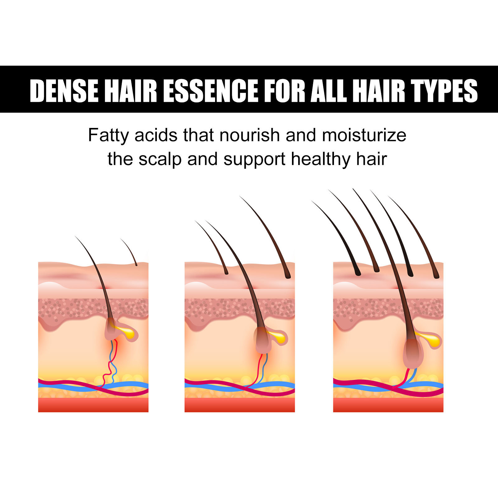 Αιθέριο Έλαιο Roll-on EELHOE για Πυκνότητα Μαλλιών Ενυδάτωση και Επανόρθωση Ρίζας Μαλλιών Σύσφιξη Πυκνότητας Μαλλιών Ενδυνάμωση Μαλλιών Περιποίηση Μαλλιών Αιθέριο Έλαιο_voghion.com