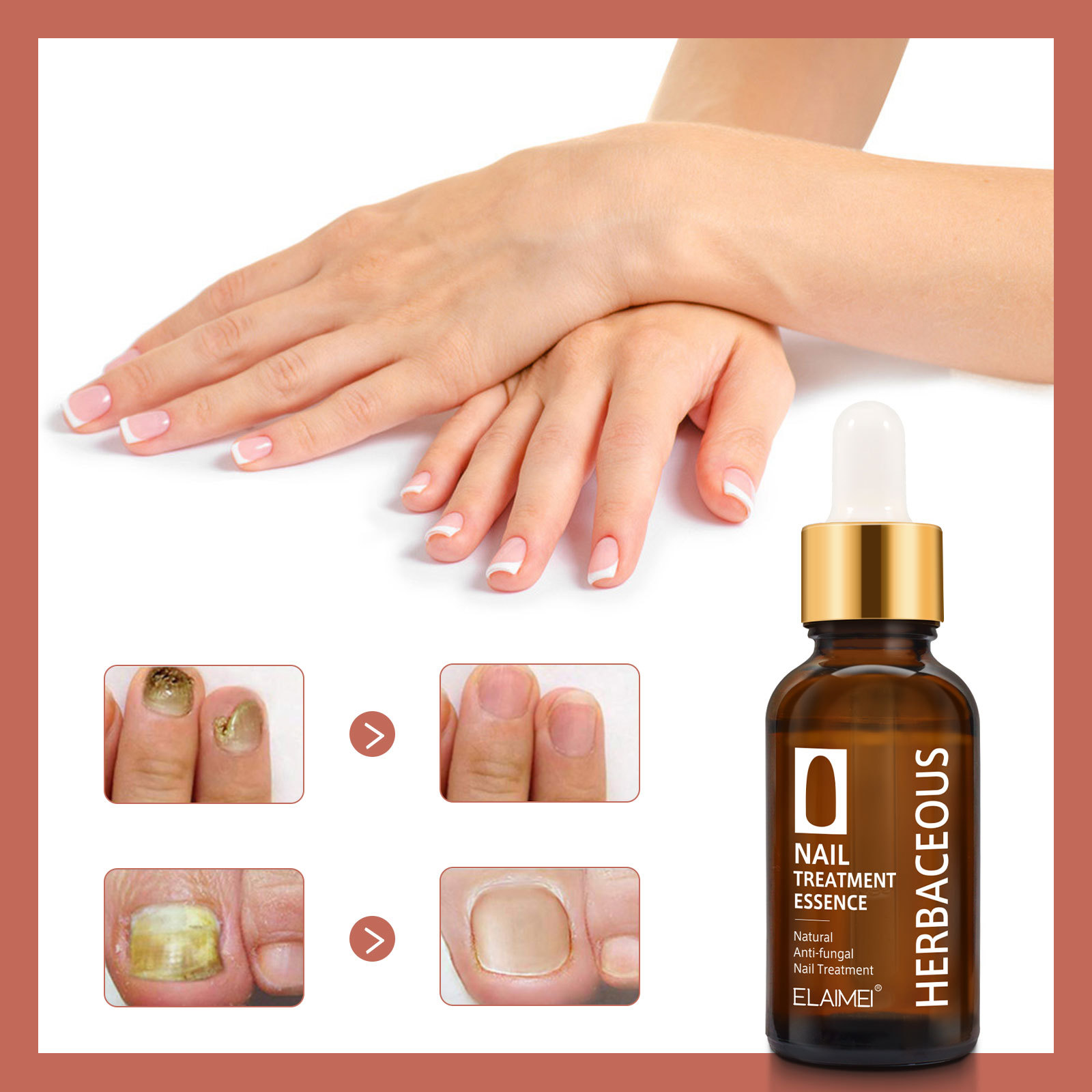 Elaimei nail care solution for foreign trade
