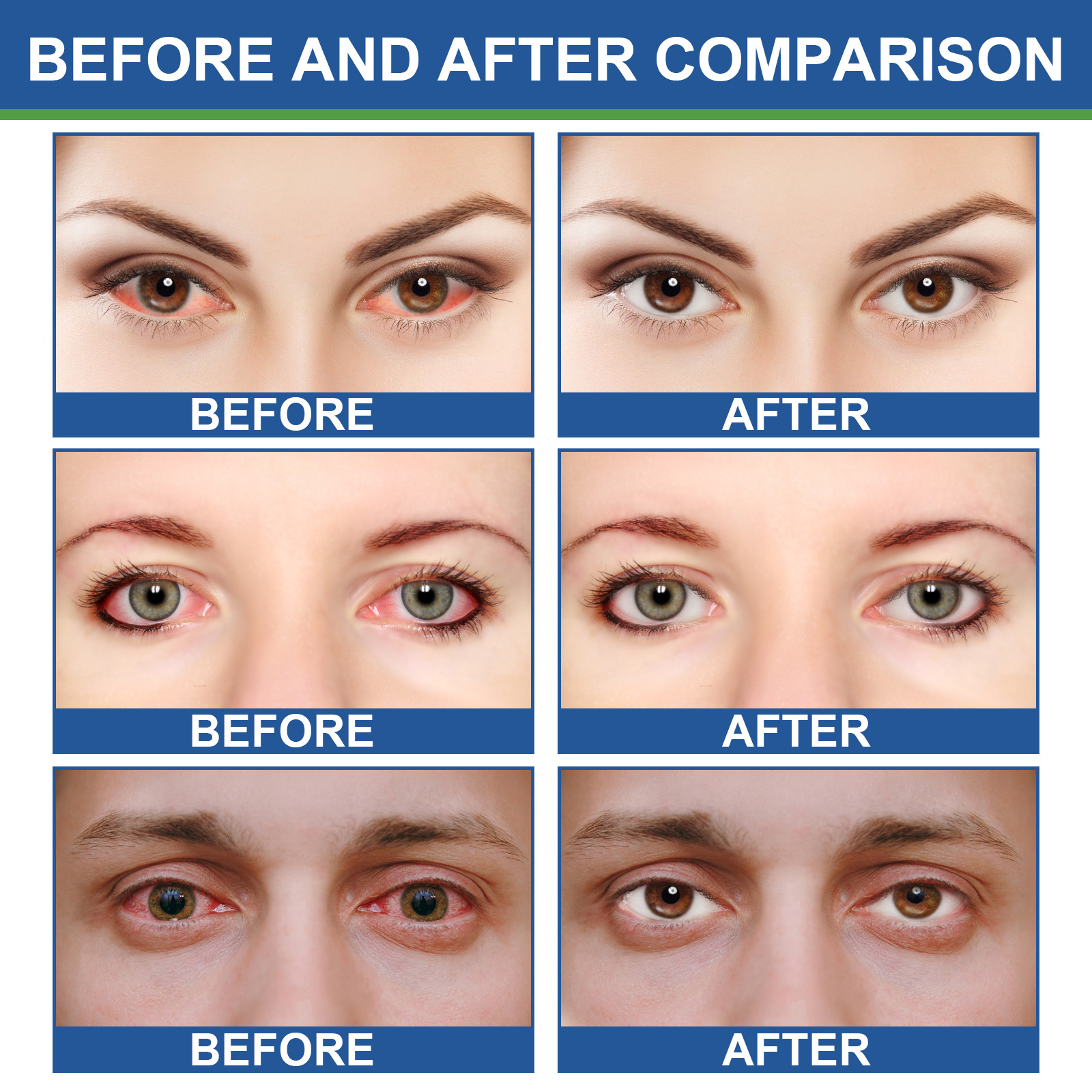 Creme para os olhos South Moon repara dor nos olhos, fadiga, ressecamento, brilho, creme hidratante suave_voghion.com