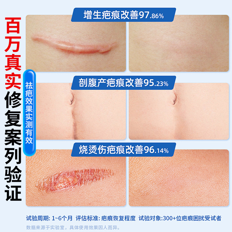 美国全英文Derm/atix倍舒痕硅凝胶15g 伤疤修复术/后伤巴克可代发|undefined