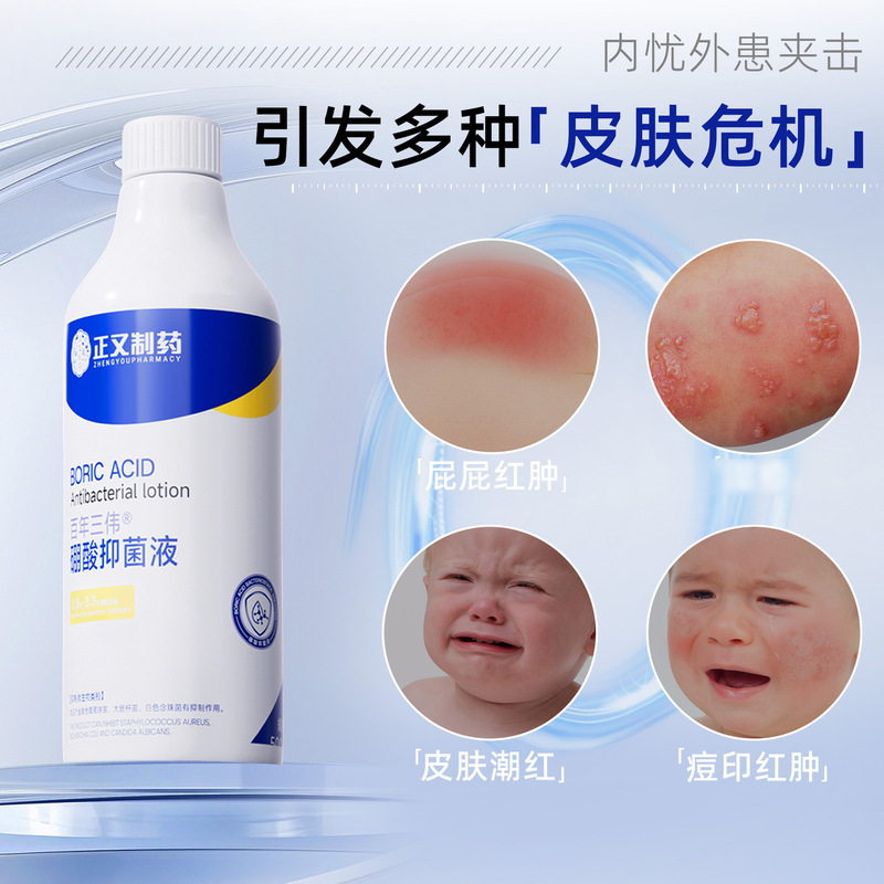 正友製薬 ホウ酸抗菌液 皮膚洗浄消毒 抗菌 500ml 大ボトル ボディ用|undefined