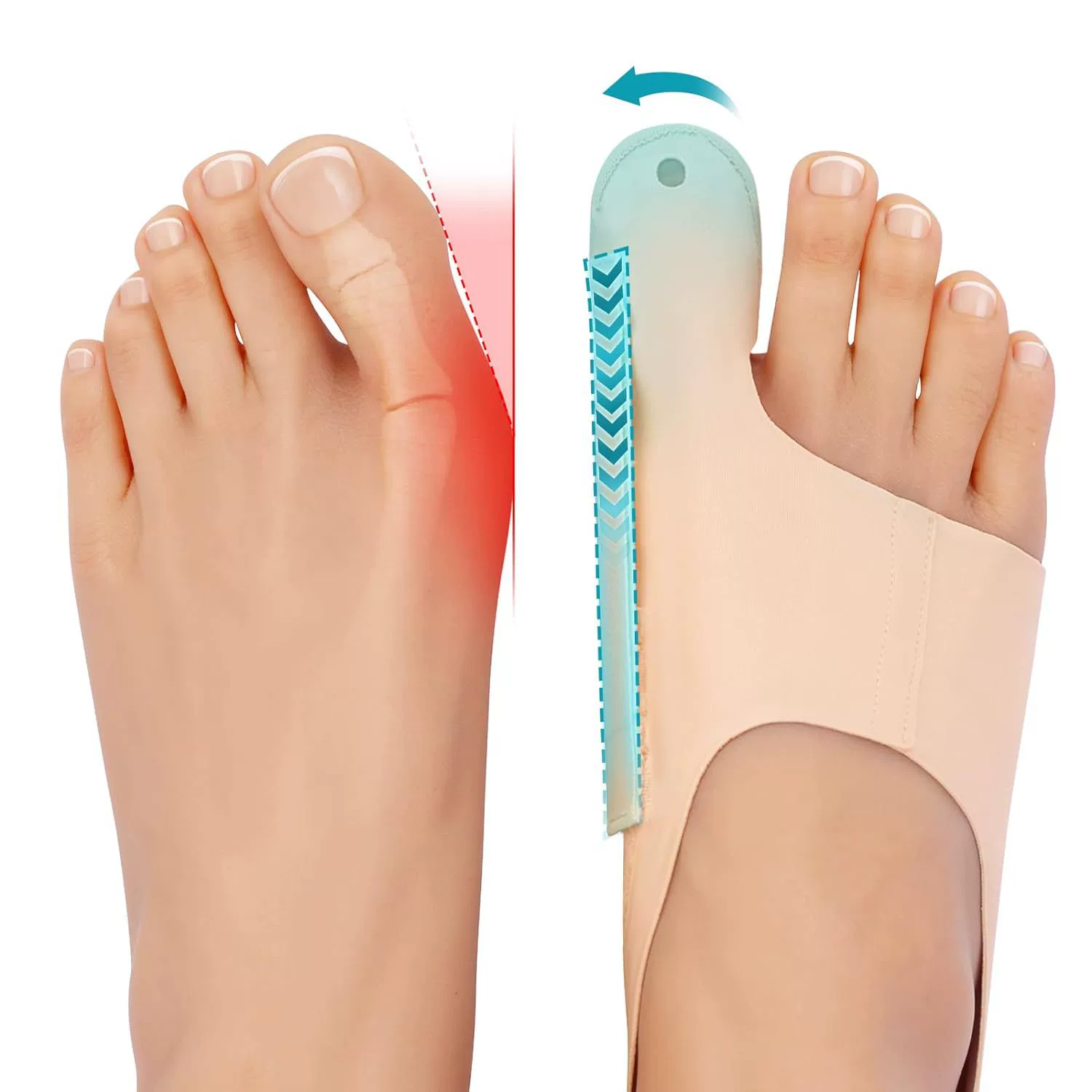 Корректор Hallux valgus Корректор регулируемый защитный чехол Hallux valgus унисекс